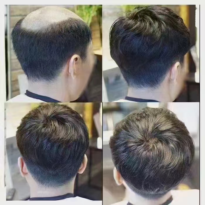 男士假發(fā)專賣店哪家好 \