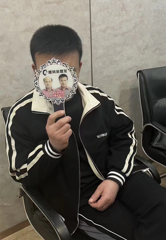 脫發(fā)做補(bǔ)發(fā)多少錢 \