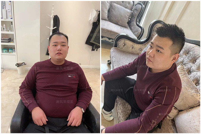 北京好的假發(fā)店在哪里能找到 \