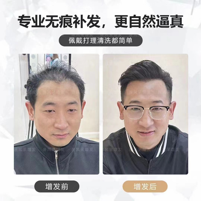 北京好的假發(fā)店在哪里能找到 \