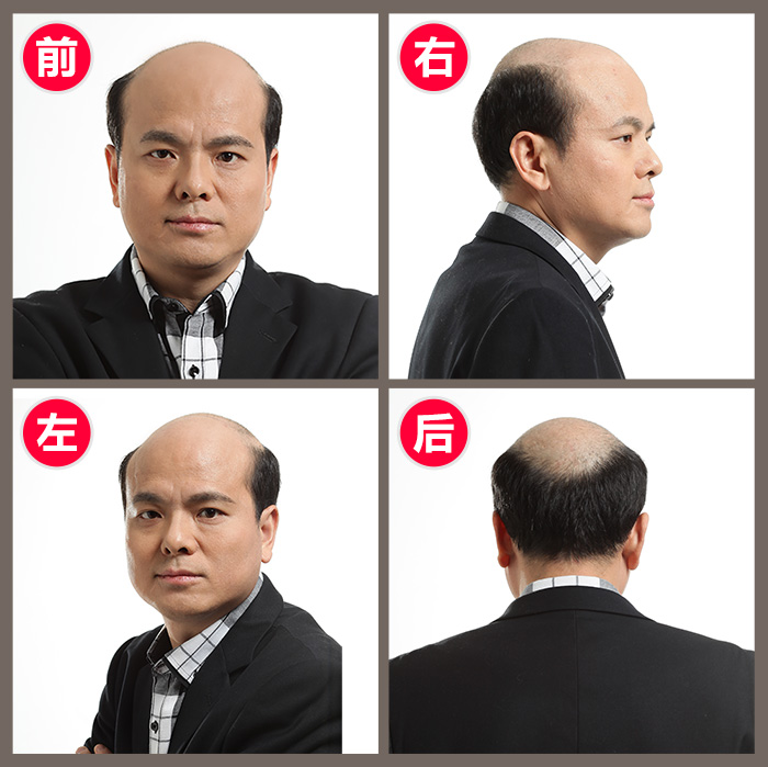 男的戴假發(fā)能看出來(lái)嗎 \