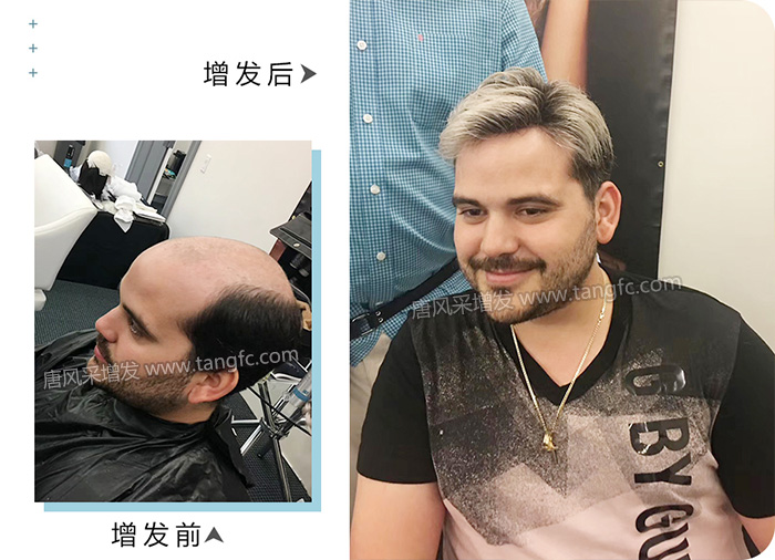 男的戴假發(fā)能看出來(lái)嗎 \