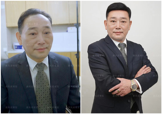 中老年人適合戴什么樣的假發(fā) \