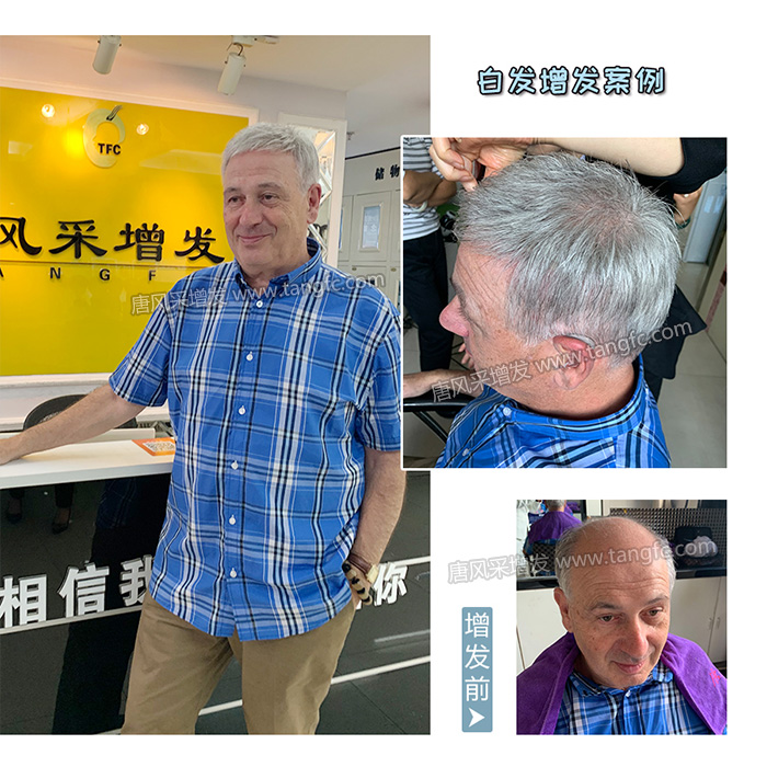 中老年人適合戴什么樣的假發(fā) \