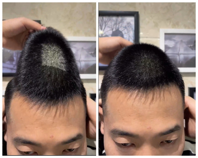 補發(fā)假發(fā) \