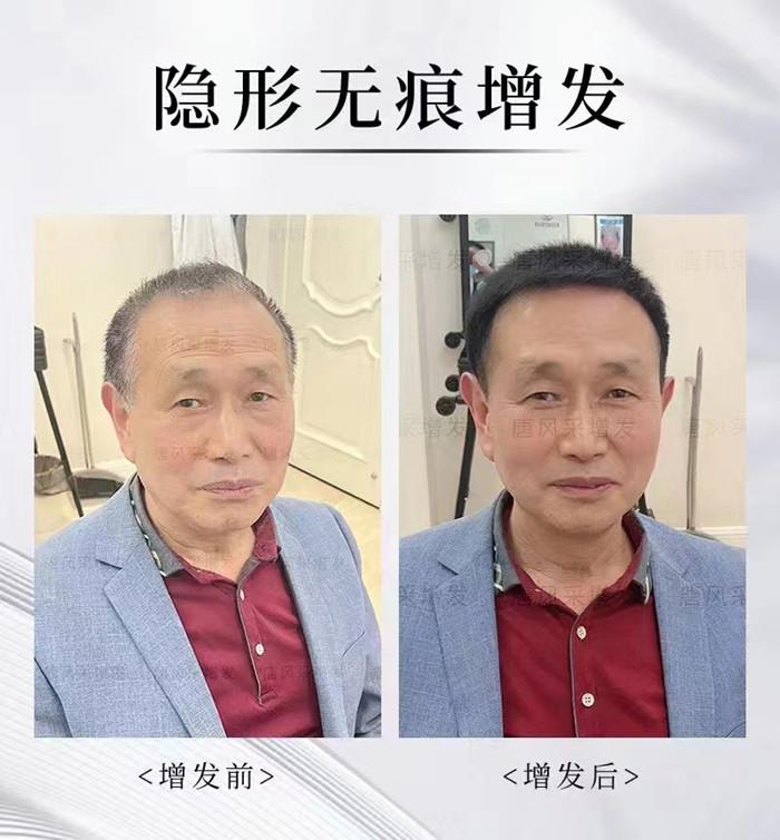 補發(fā)假發(fā) \