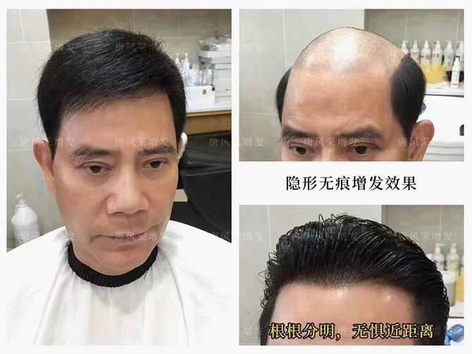 遮白發(fā)遮禿的局部假發(fā)片 \