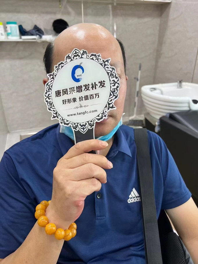 合肥假發(fā)怎么選 \