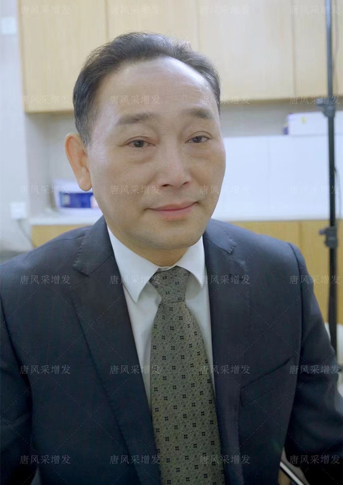 無(wú)錫男士假發(fā) \