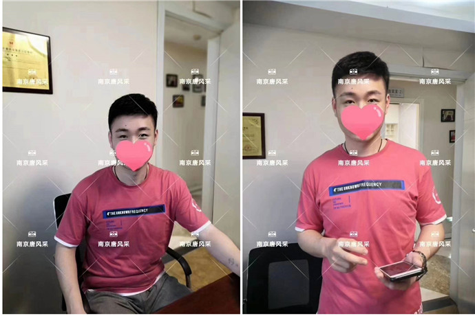 無(wú)痕增發(fā) \