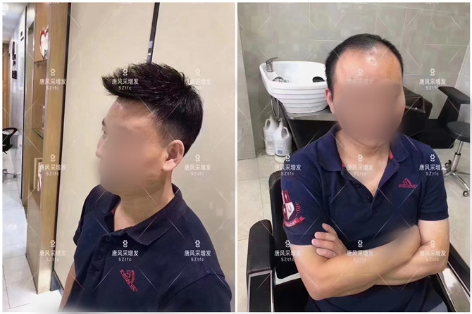 泉州男士假發(fā) \