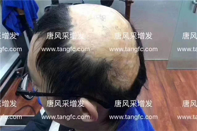 石家莊男士假發(fā)哪家強(qiáng) \