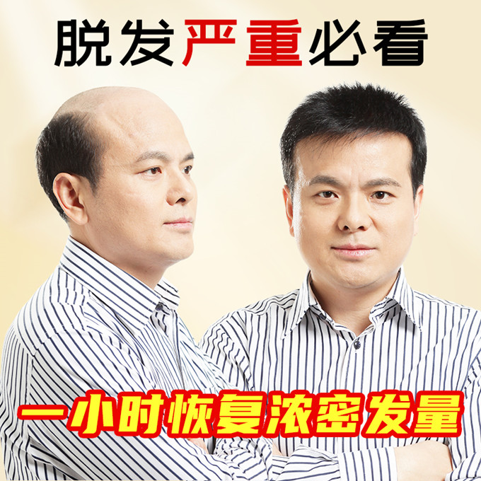 石家莊假發(fā)男士改造 \