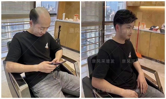 福州男士假發(fā) \