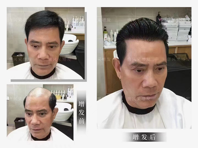 福州男士假發(fā)怎么選 \