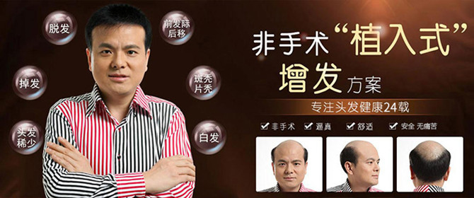 福州男士假發(fā) \