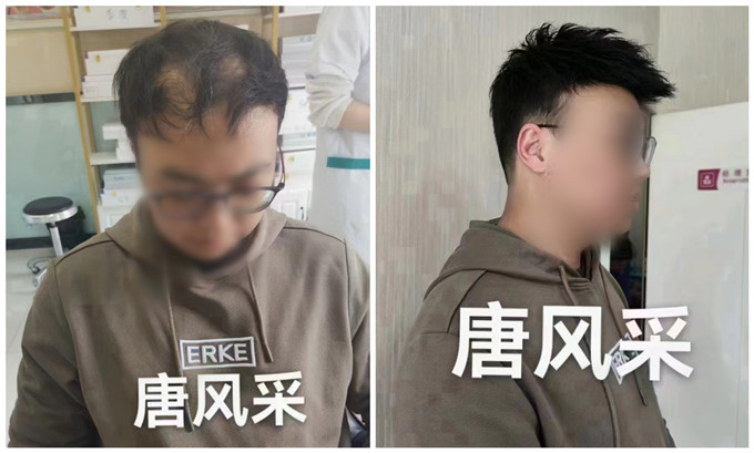 郴州假發(fā)購(gòu)買(mǎi) \