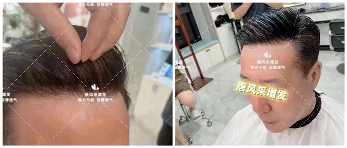 郴州假發(fā)片 \