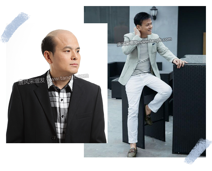 柳州假發(fā)攻略 \