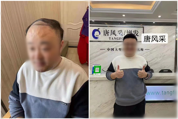 柳州假發(fā)攻略 \