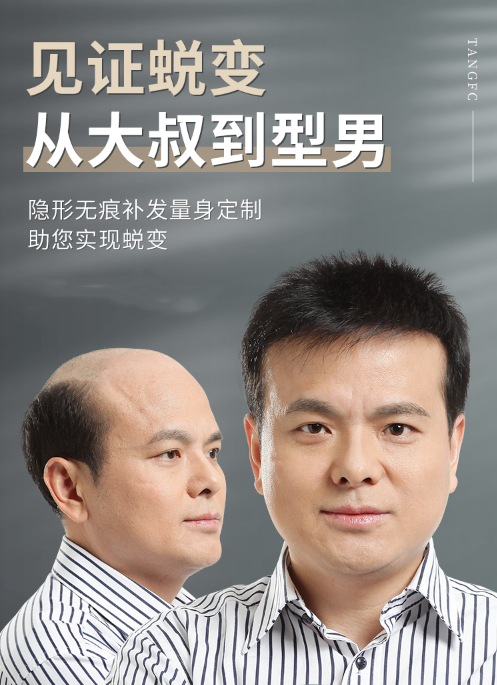 柳州假發(fā)攻略 \