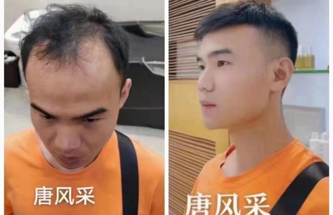 補(bǔ)發(fā)假發(fā) \