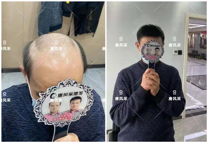 蘇州男士假發(fā)銷售量 \