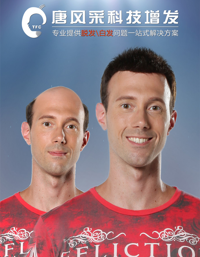 蘇州男士假發(fā)銷售量 \