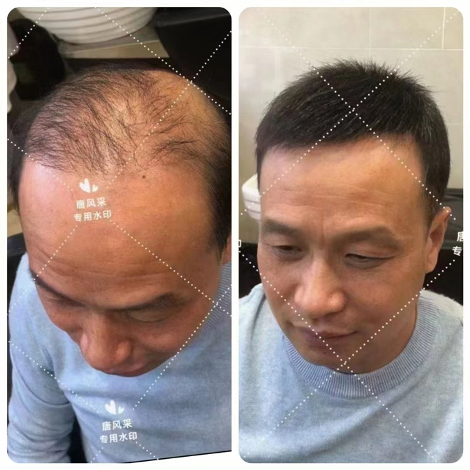 蘇州男士時尚假發(fā) \