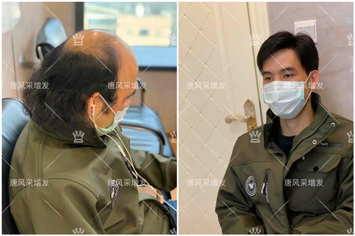 蘇州男士時尚假發(fā) \