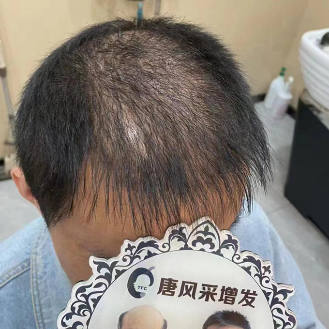 長沙哪里有男假發(fā)賣 \