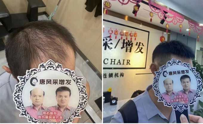 天津定制假發(fā)哪家好 \