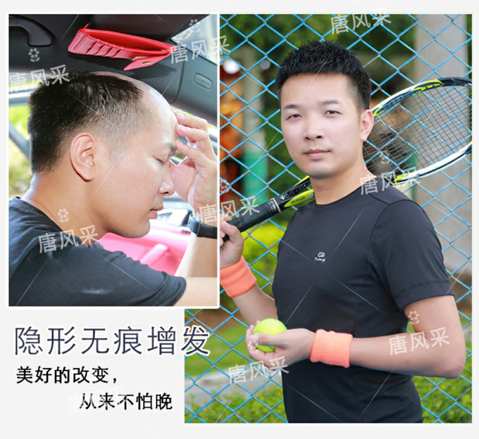 天津定制假發(fā)哪家好 \