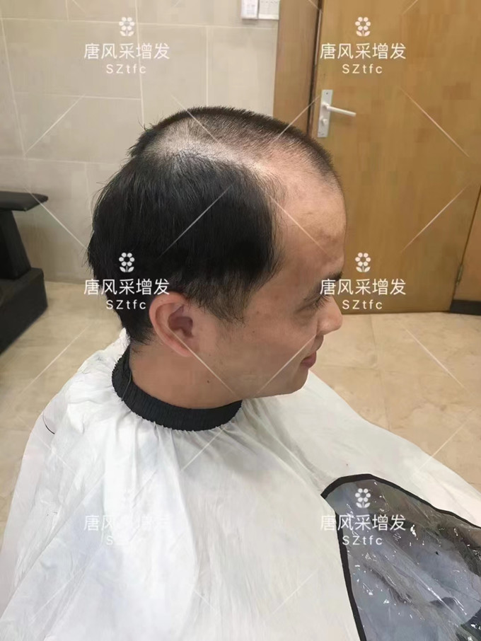 天津假發(fā)店 \