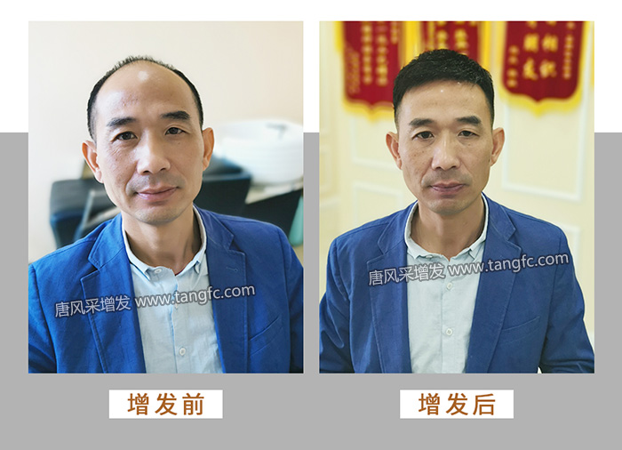 長沙岳麓區(qū)假發(fā)專賣店 \