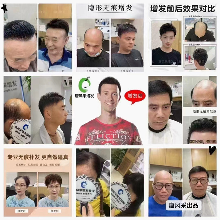 廣州男士假發(fā) \