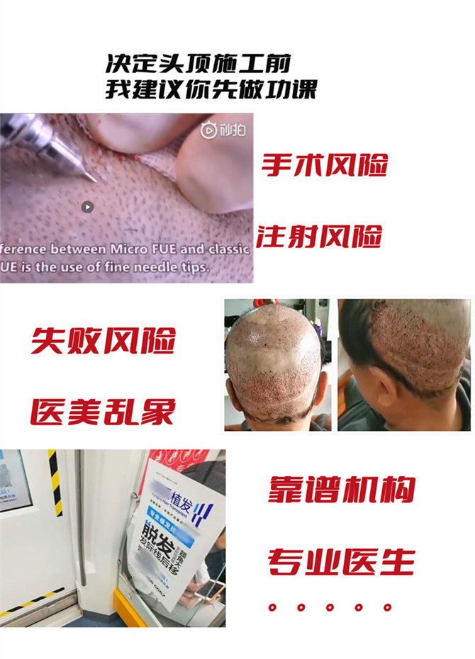 西安假發(fā)定制 \