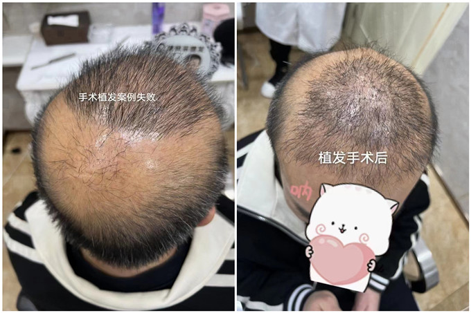 濟(jì)南假發(fā)實(shí)體店 \