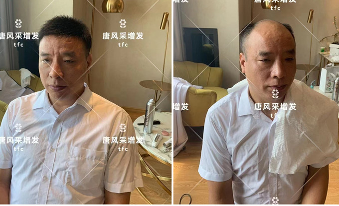 濟(jì)南假發(fā)實(shí)體店 \