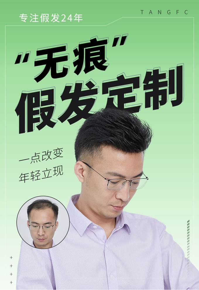 變高的發(fā)際線 \