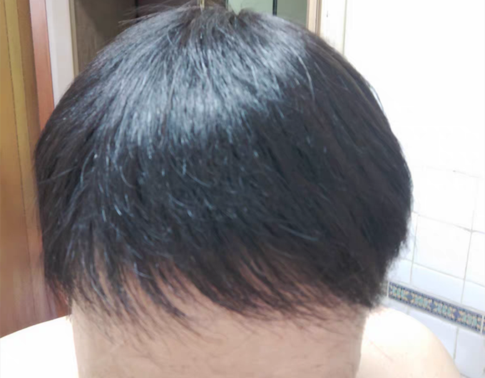 長沙芙蓉區(qū)假發(fā)店 \