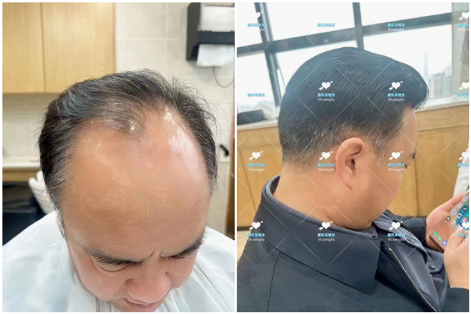 長沙芙蓉區(qū)假發(fā)店 \