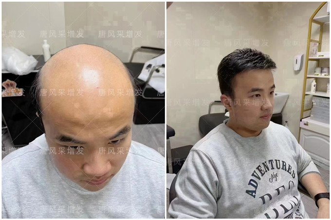 長(zhǎng)沙芙蓉區(qū)哪有假發(fā)店 \