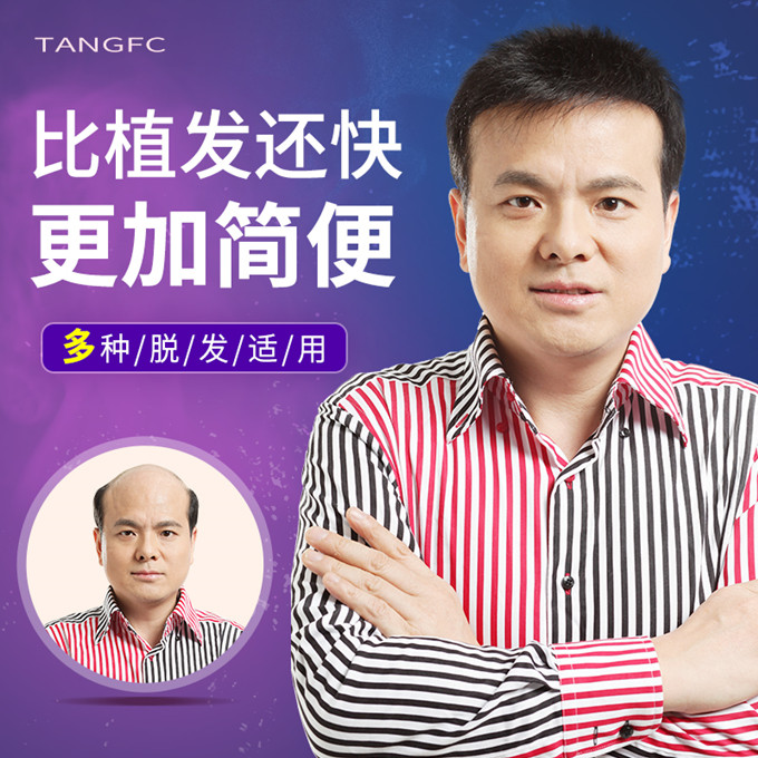 北京定制假發(fā) \