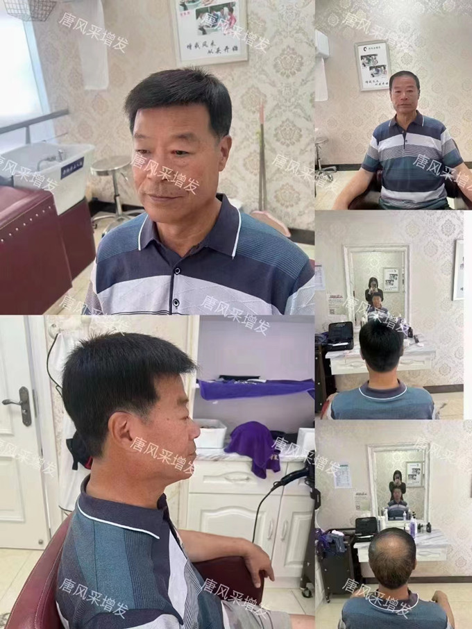 北京定制假發(fā) \