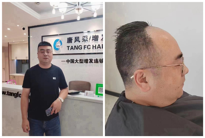 大同假發(fā)訂做 \