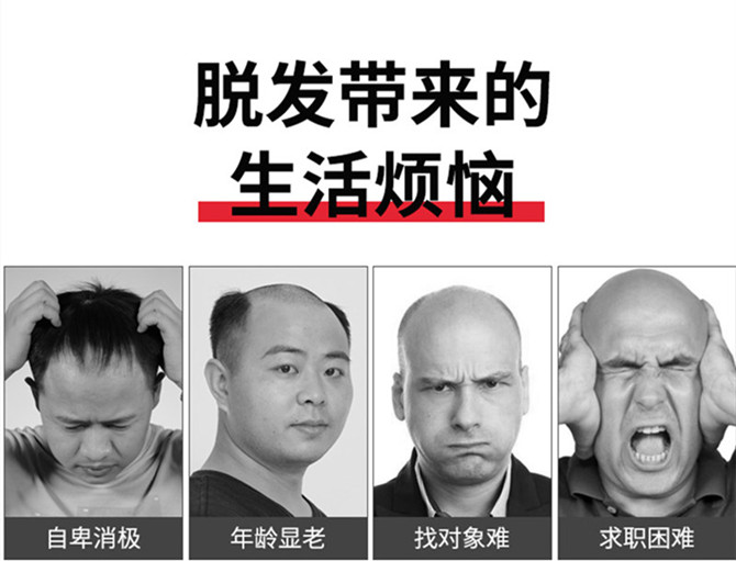 漳州定制假發(fā)品牌 \