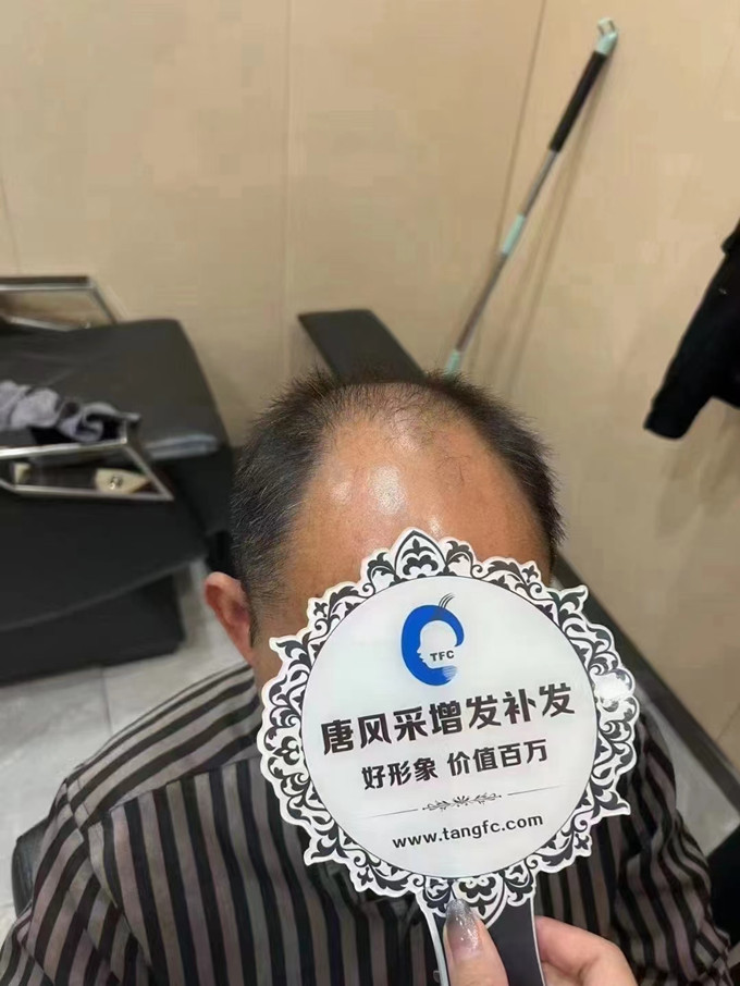 漳州定制假發(fā)品牌 \