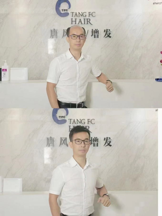 漳州假發(fā)實(shí)體店 \