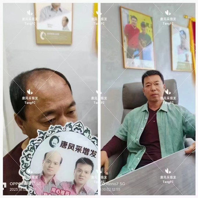 漳州假發(fā)實(shí)體店 \